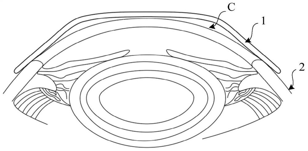 Orthokeratology lenses for myopia control