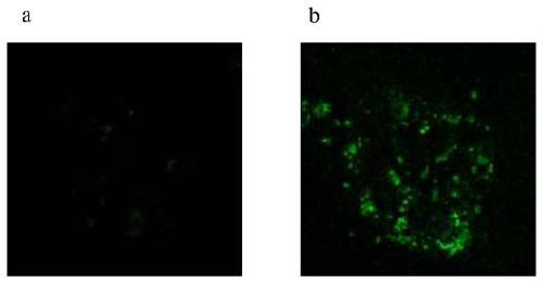 Novel liver targeting drug carrier