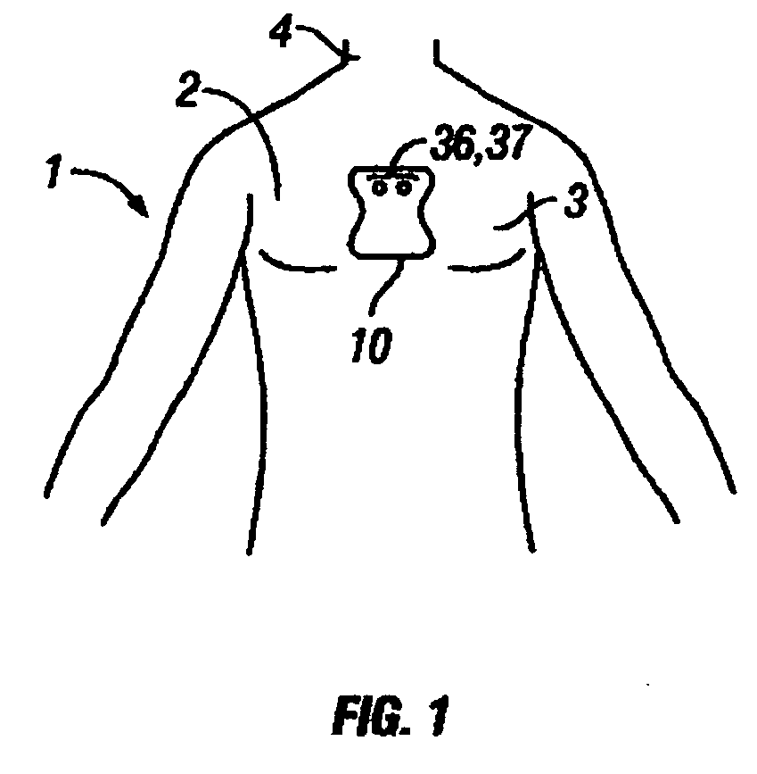 Disposable extended wear heart monitor patch