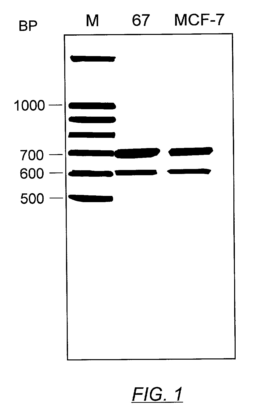 Methods and compositions utilizing an alternative splice variant of the sigma-1 receptor