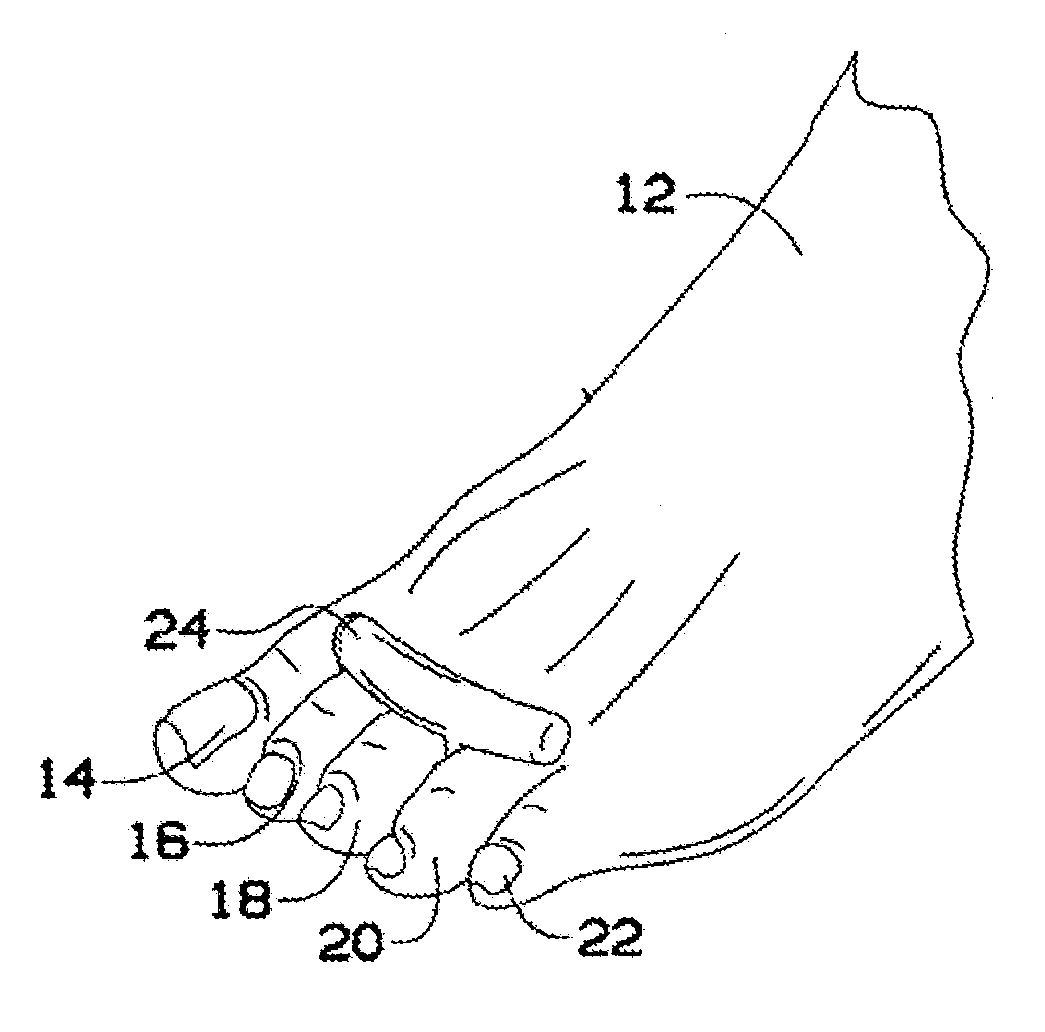 Device Used to Realign Hammertoe Deformities