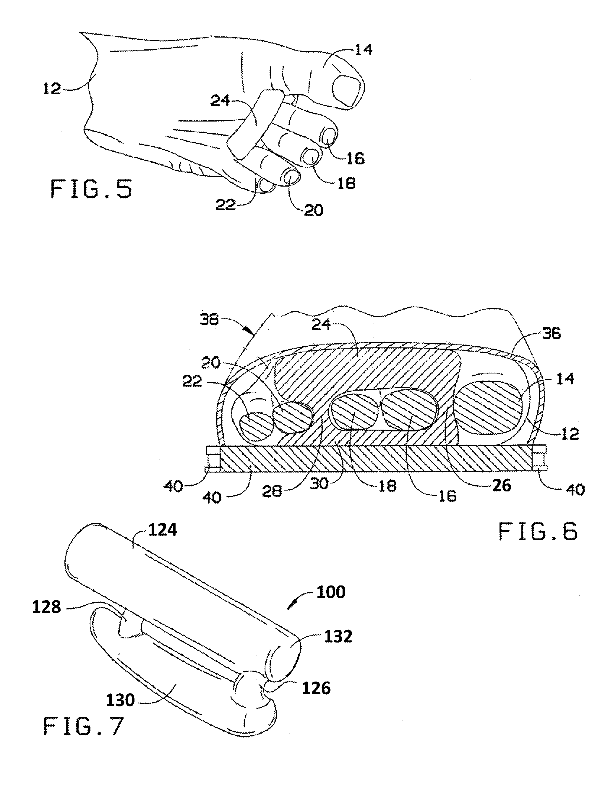 Device Used to Realign Hammertoe Deformities