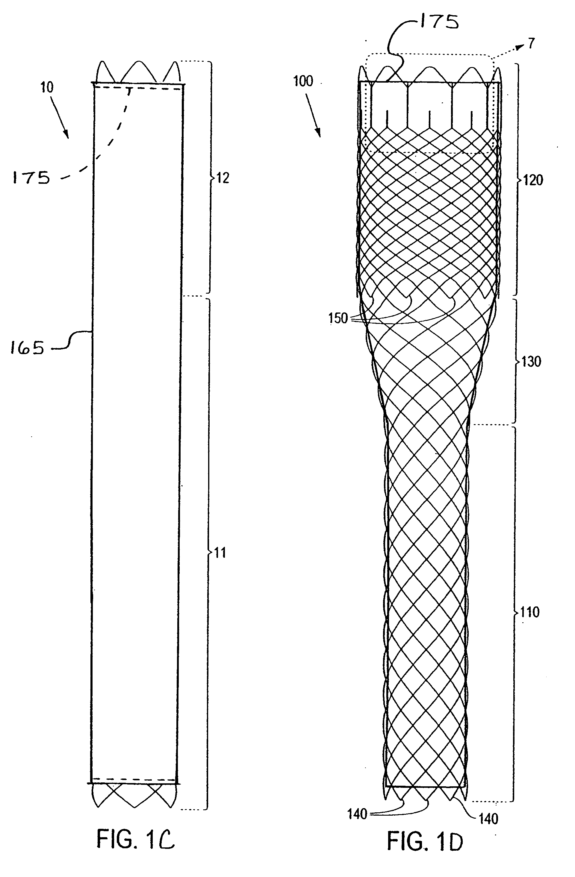 Braided stent and method for its manufacture