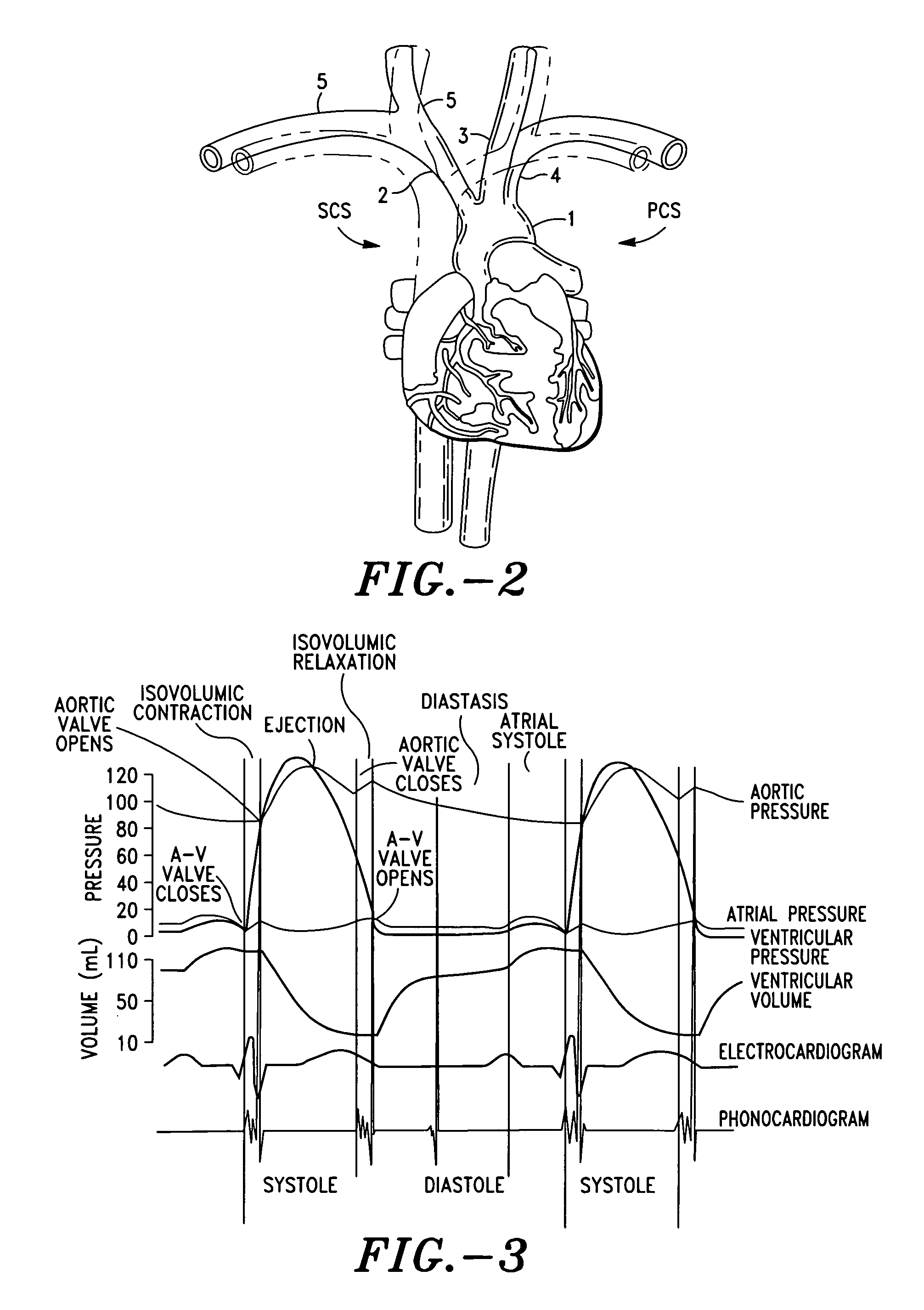 Method and system for determining cardiac performance