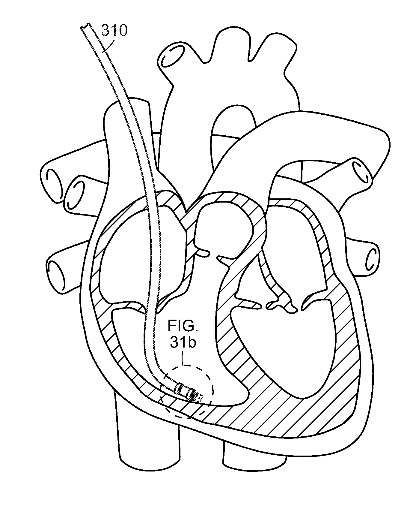 Methods and systems for assessing cardiac fibrillogenicity