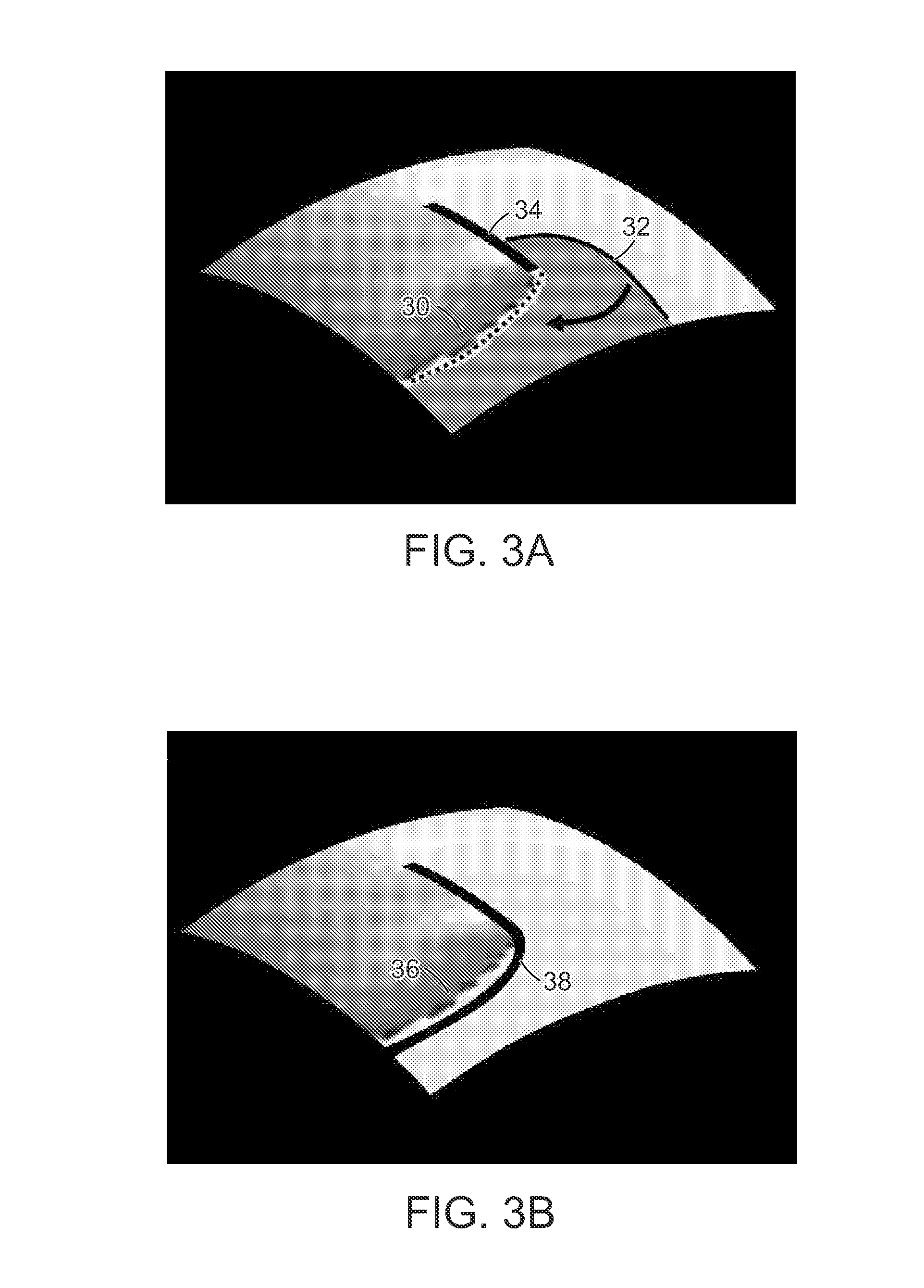 Methods and systems for assessing cardiac fibrillogenicity