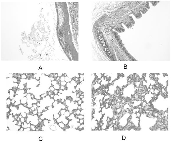 Voriconazole aerosol inhalant and application thereof