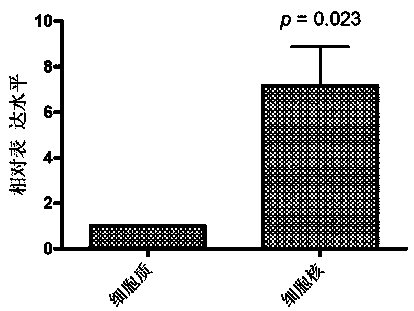 Cyclic RNA circBCBM1 and non-diagnostic fluorescent quantitative detection method