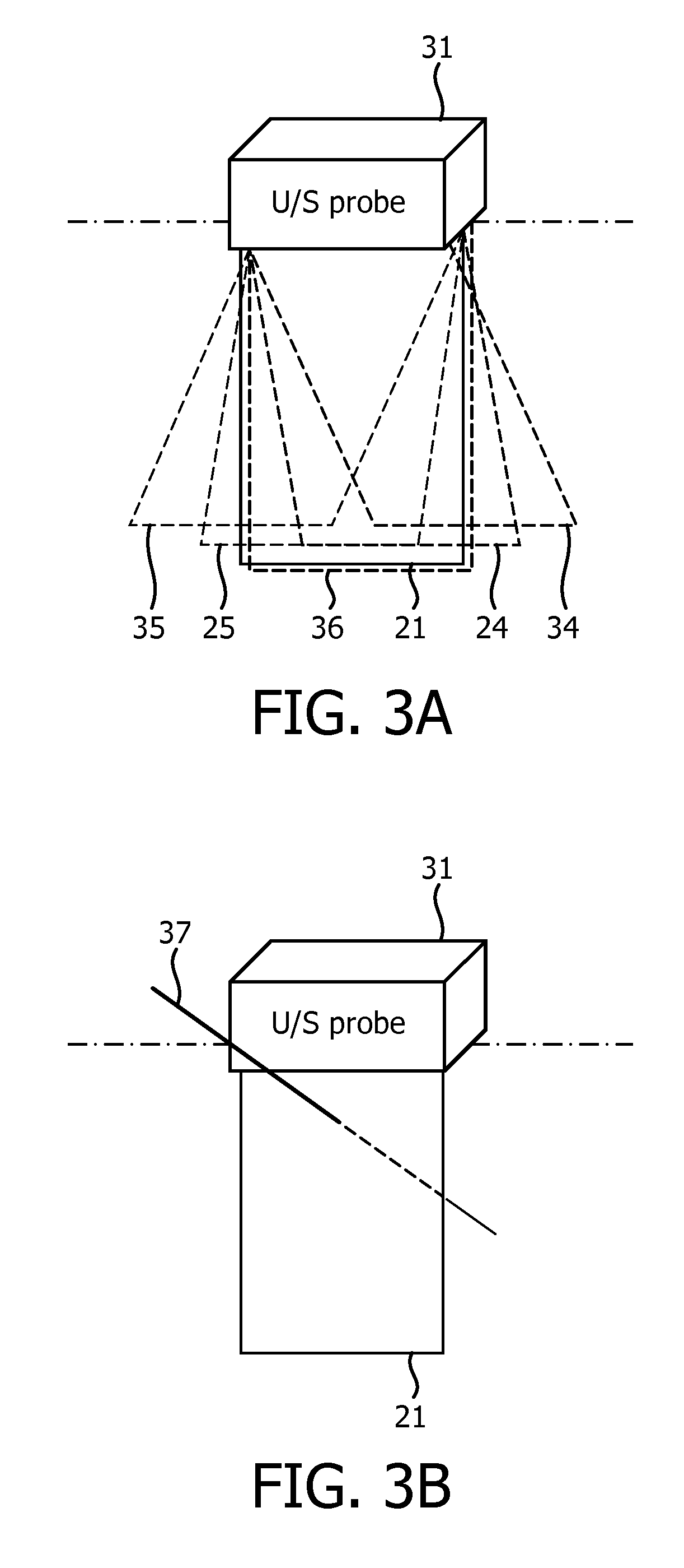 Ultrasonic imaging apparatus and a method for imaging a specular object and a target anatomy in a tissue using ultrasound