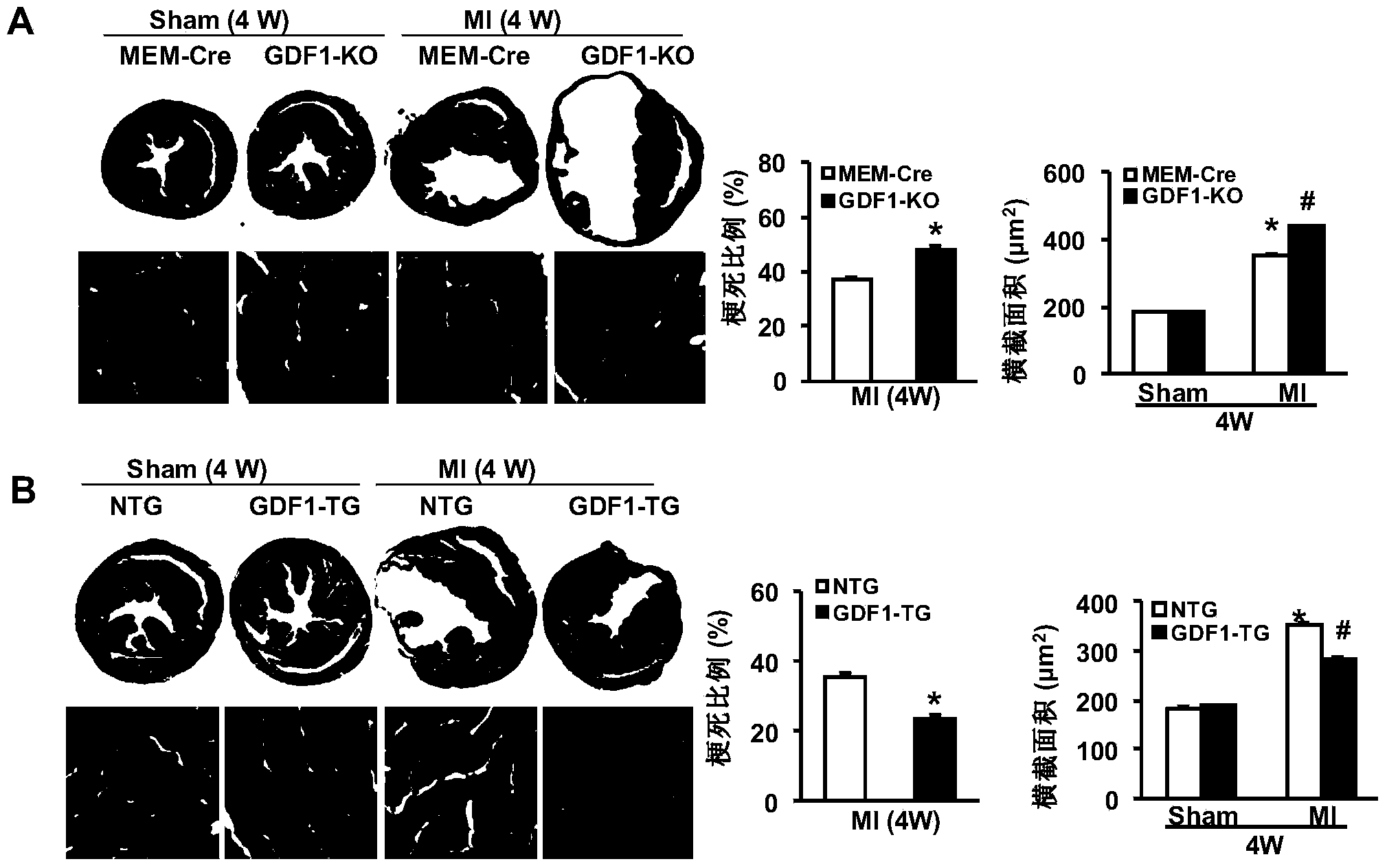 Function and application of growth differentiation factor 1 (GDF1) to coronary atherosclerotic heart disease