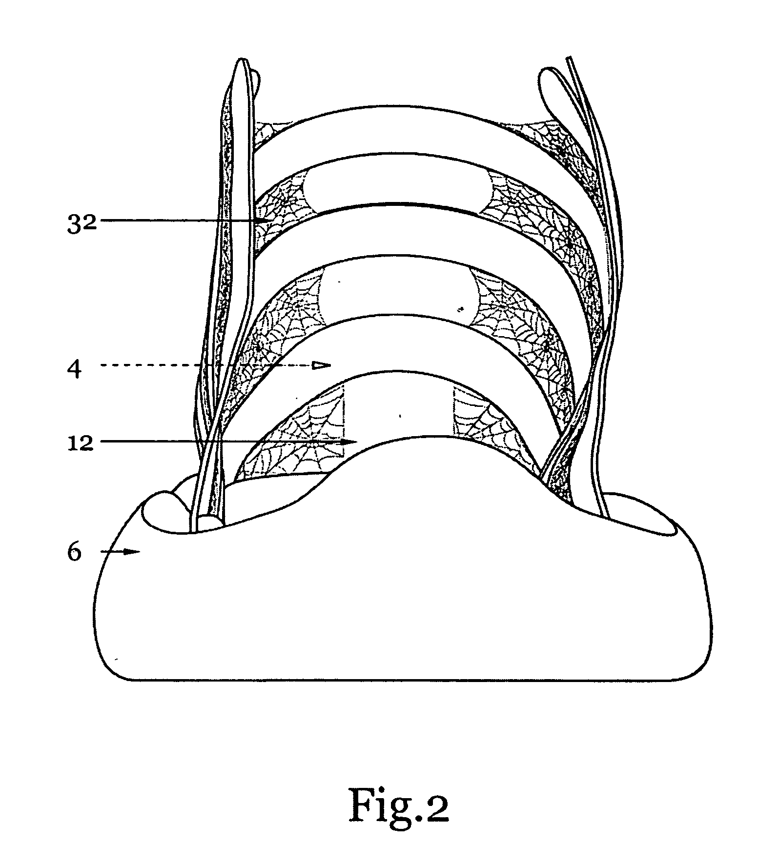 Shoe and ankle support with artificial spider web silk