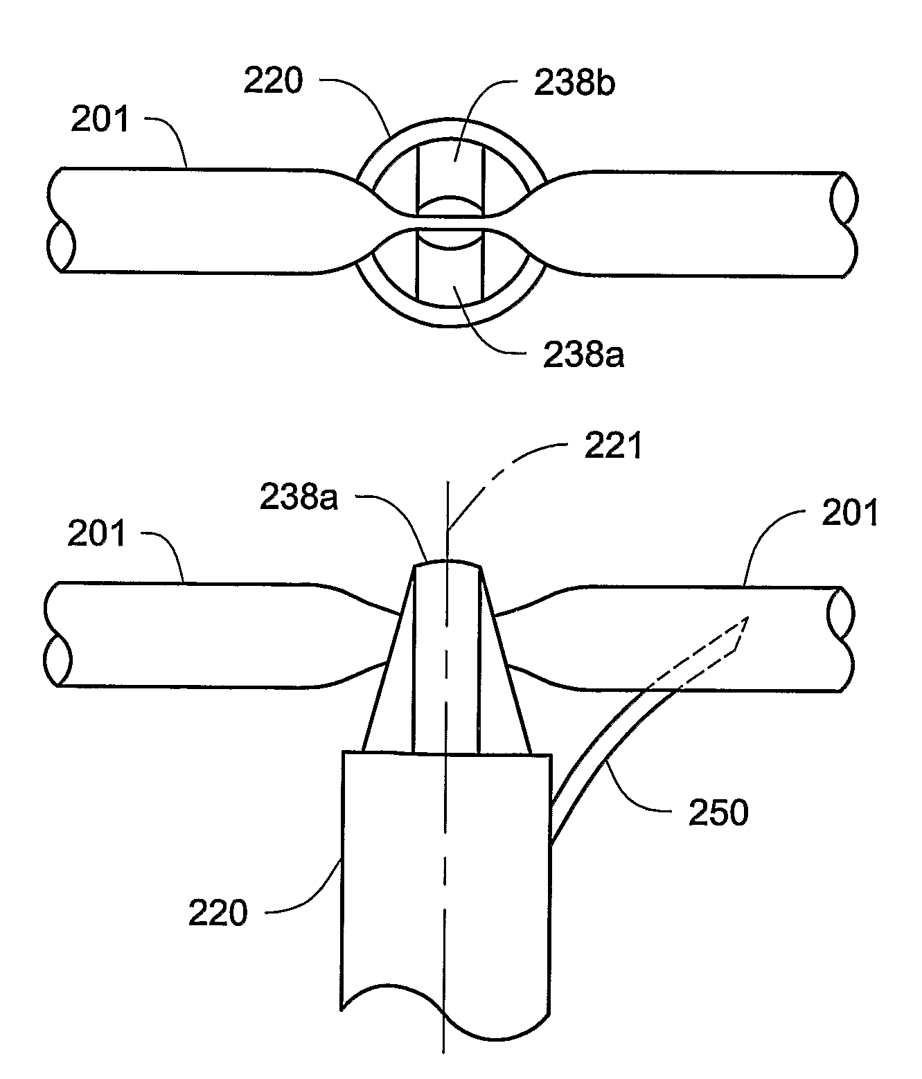 Vein closure and injection kits and methods