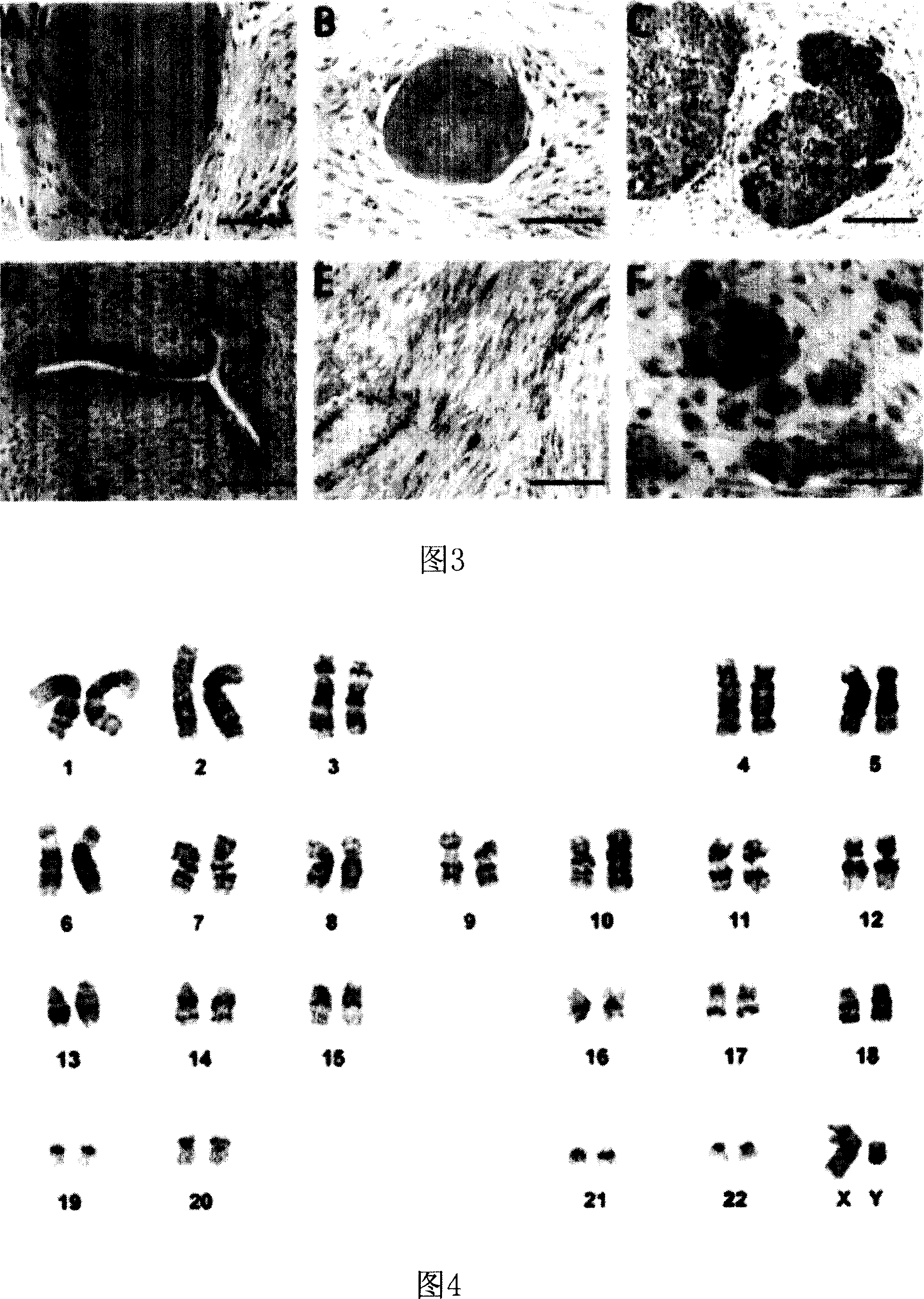 Use of Activin A in human embryo stem cell trophoblast-free cell culture