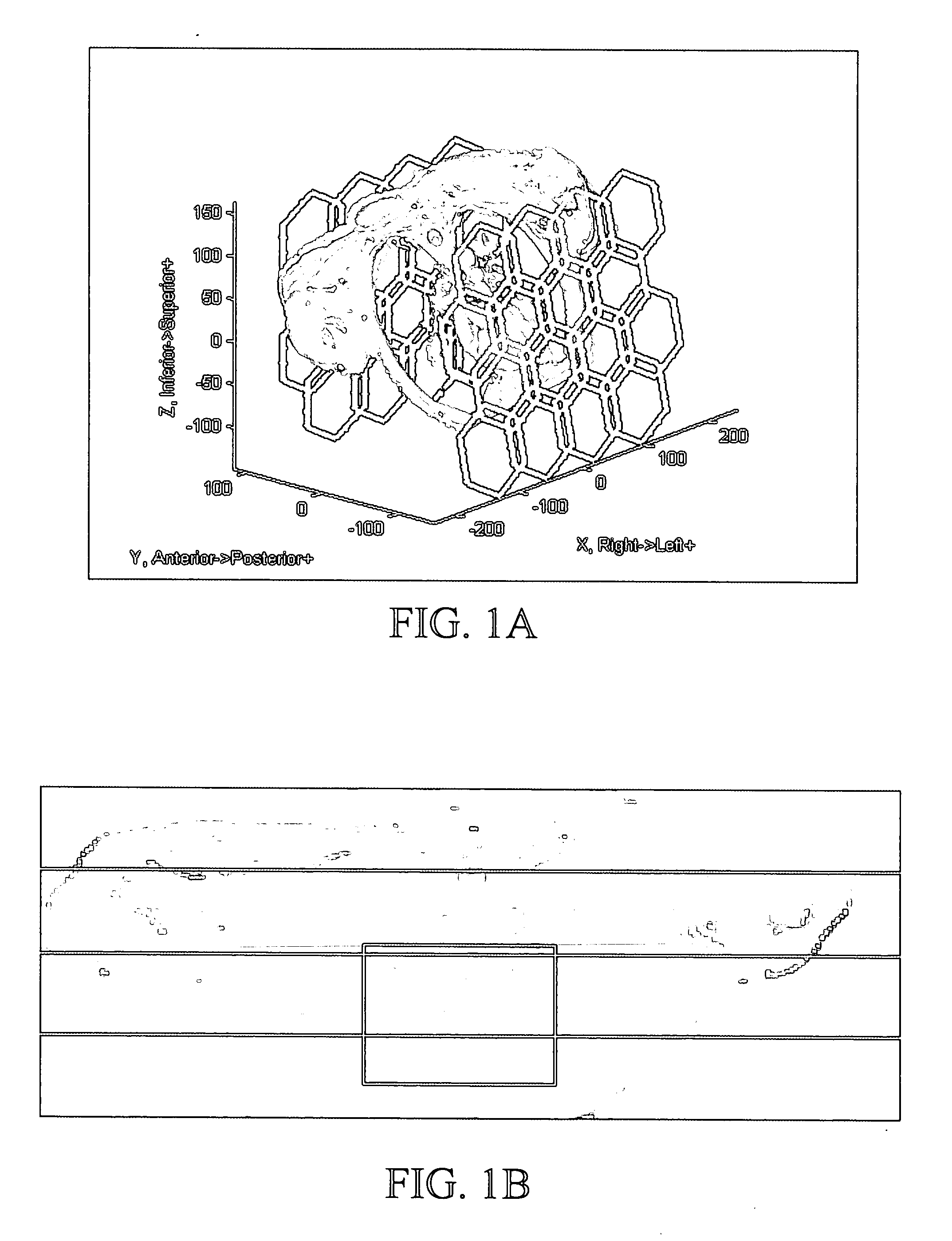 Method and apparatus for adaptive channel reduction for parallel imaging