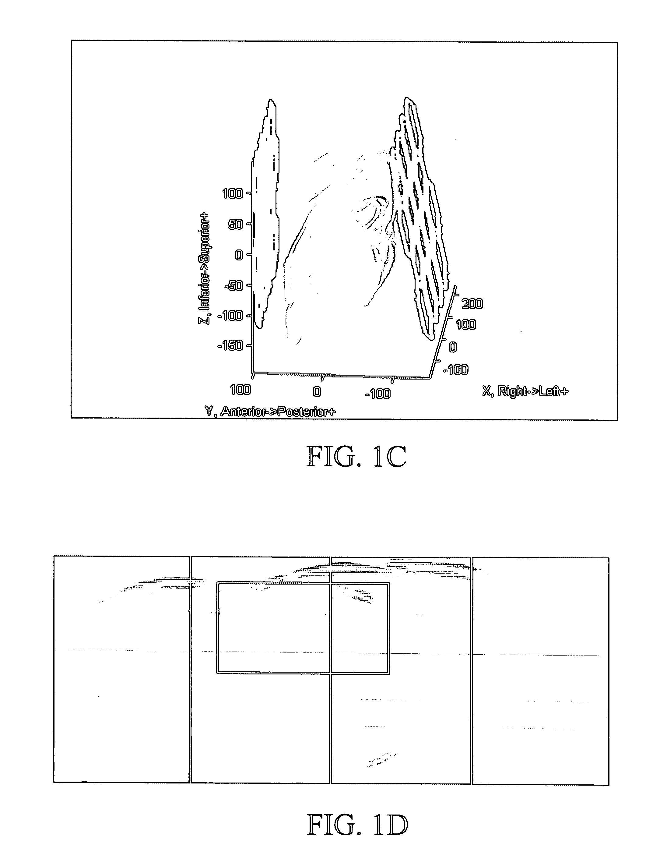 Method and apparatus for adaptive channel reduction for parallel imaging