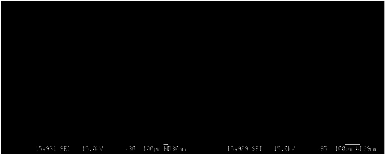 Triamcinolone acetonide soluble micro-needle and preparation method thereof