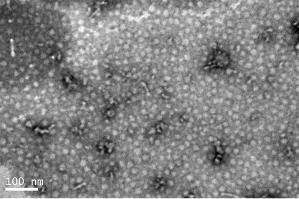 Antibody, polypeptide and nucleic acid combination therapy targeting carrier and its preparation method and application