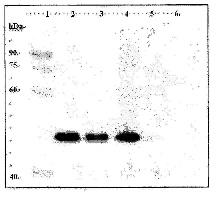 Preparation method, coding sequences and use of anti-CP4 5-enolpyruvyl-shikimate-3-phosphate synthase (EPSPS) monoclonal antibody