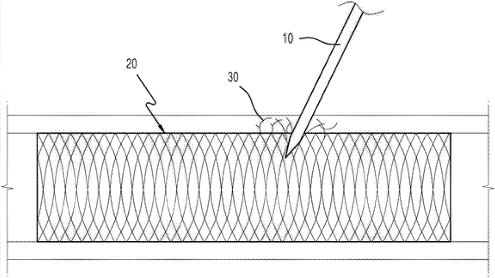 Stent and artificial vessel having the same