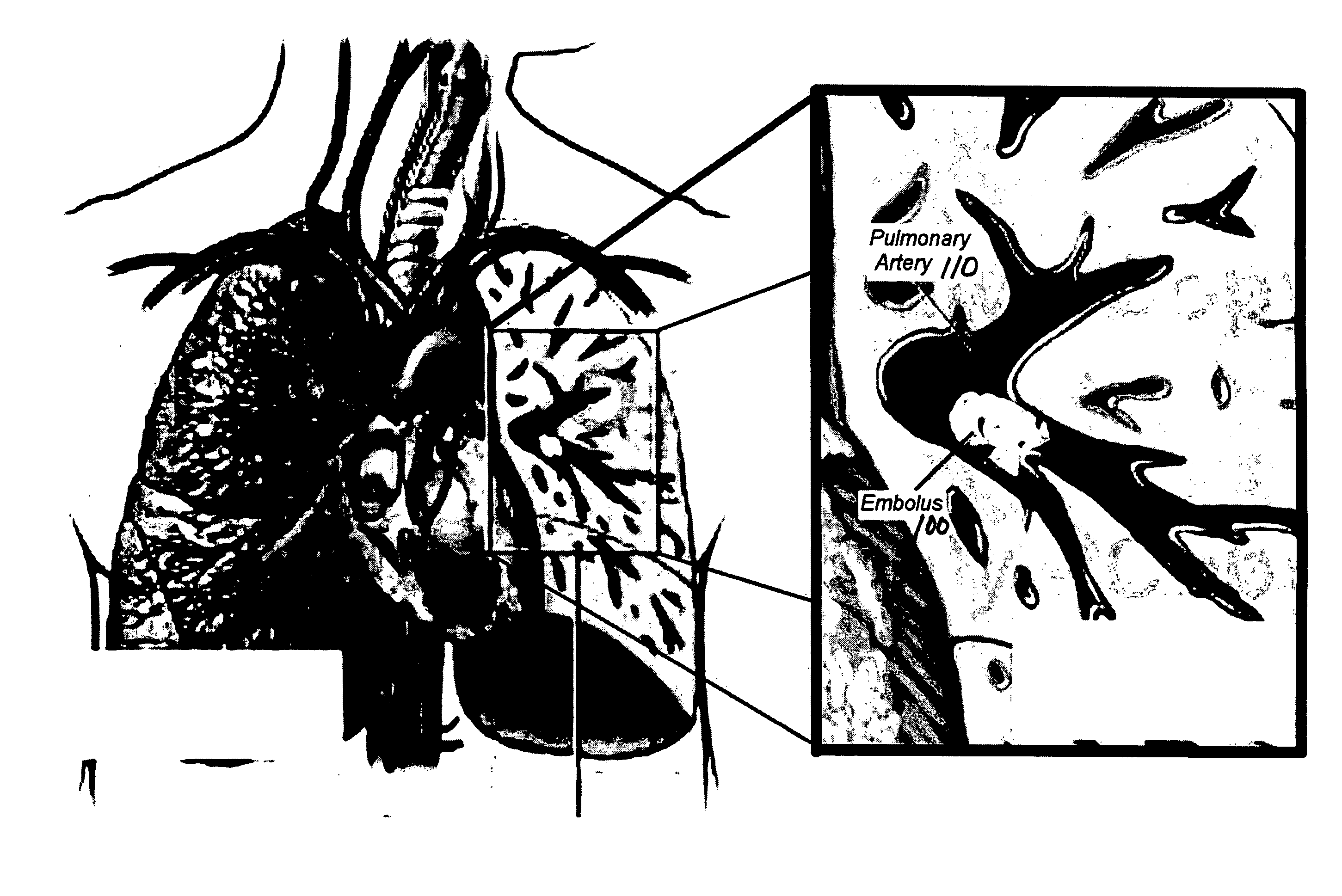 Method for segmenting arteries and veins