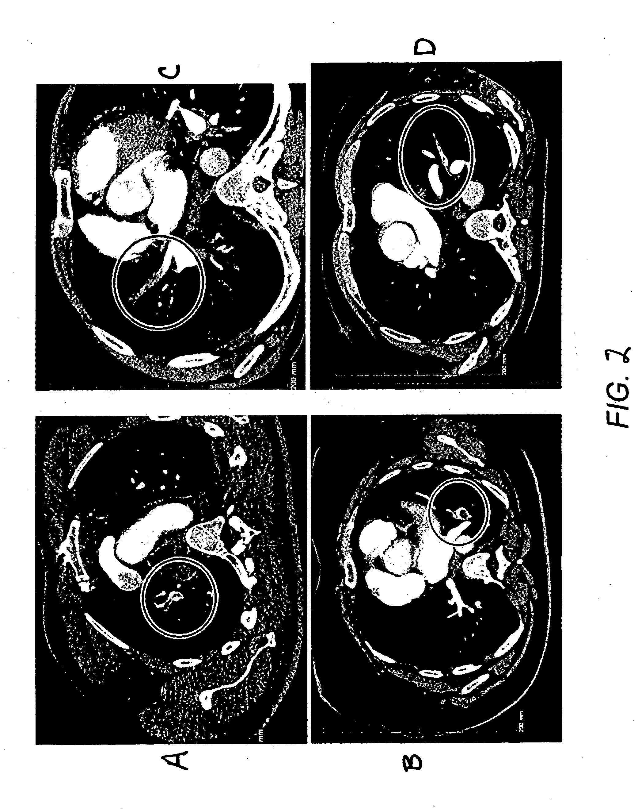 Method for segmenting arteries and veins