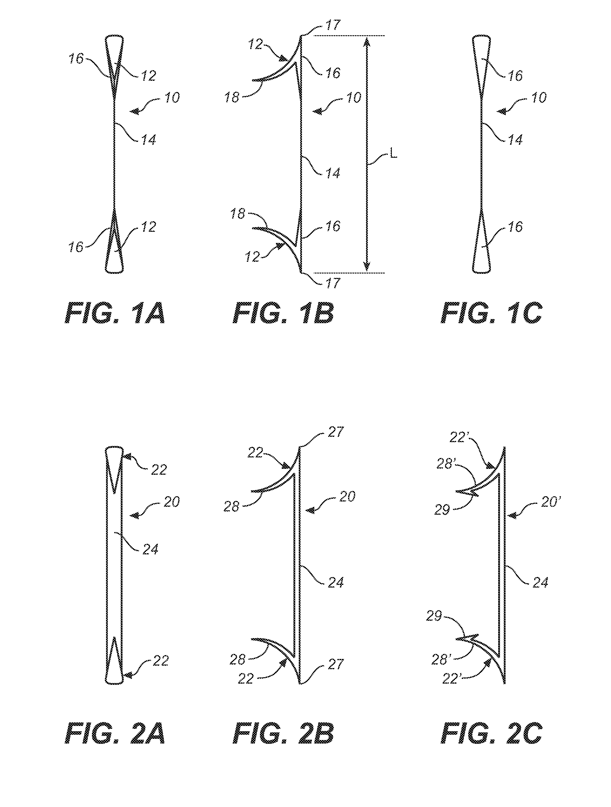 Prosthesis Fixation Apparatus and Methods