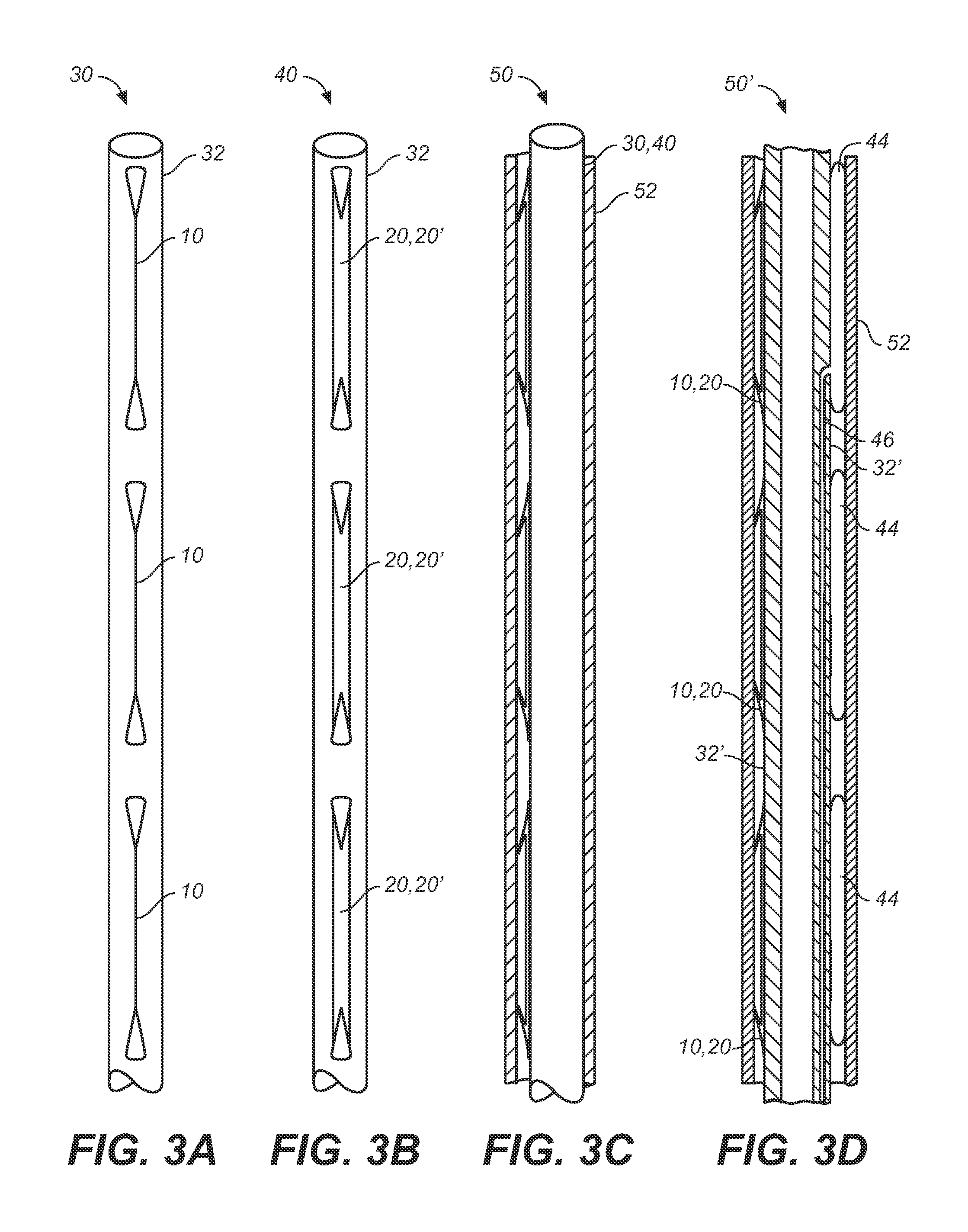 Prosthesis Fixation Apparatus and Methods