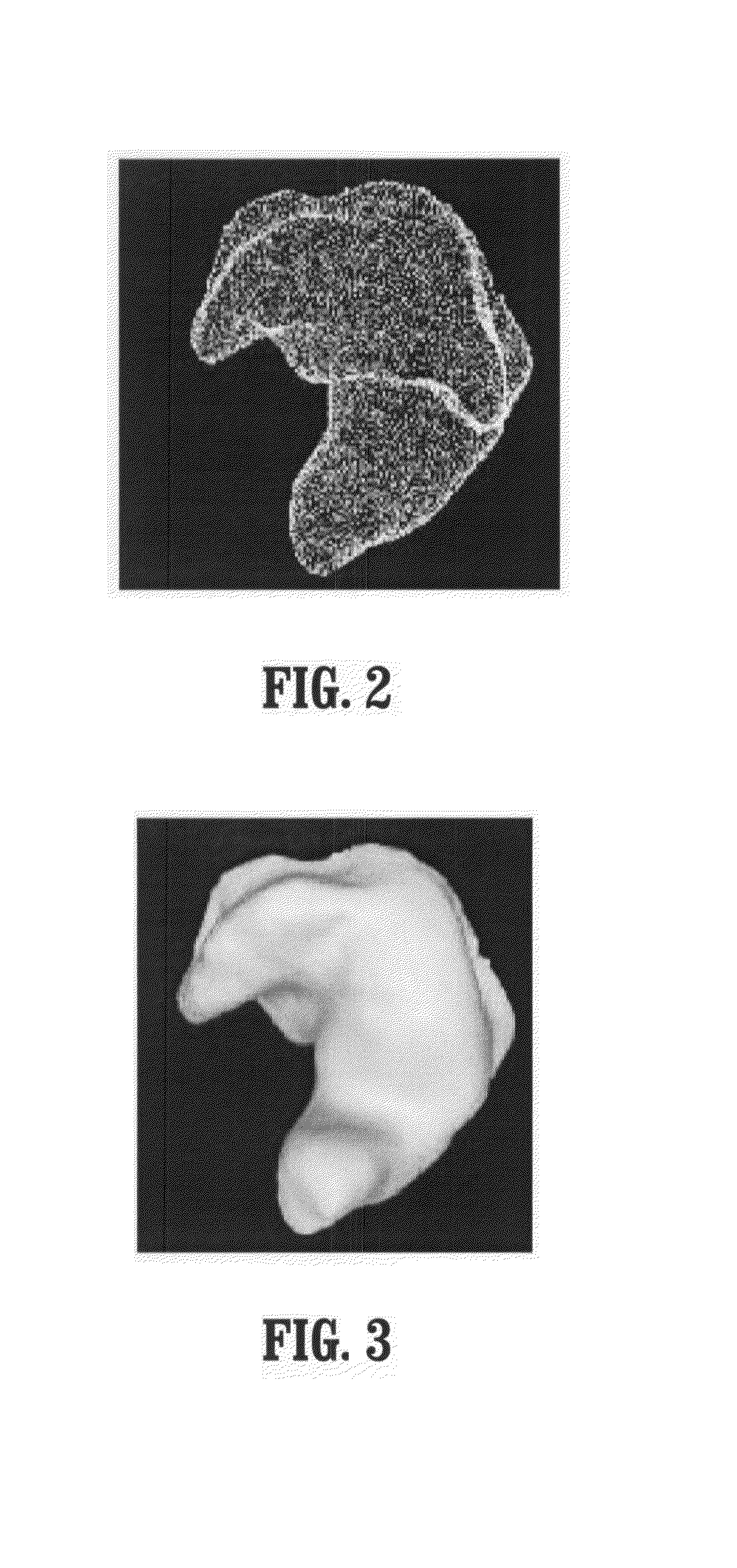 Automatic binaural shell modeling for hearing aids