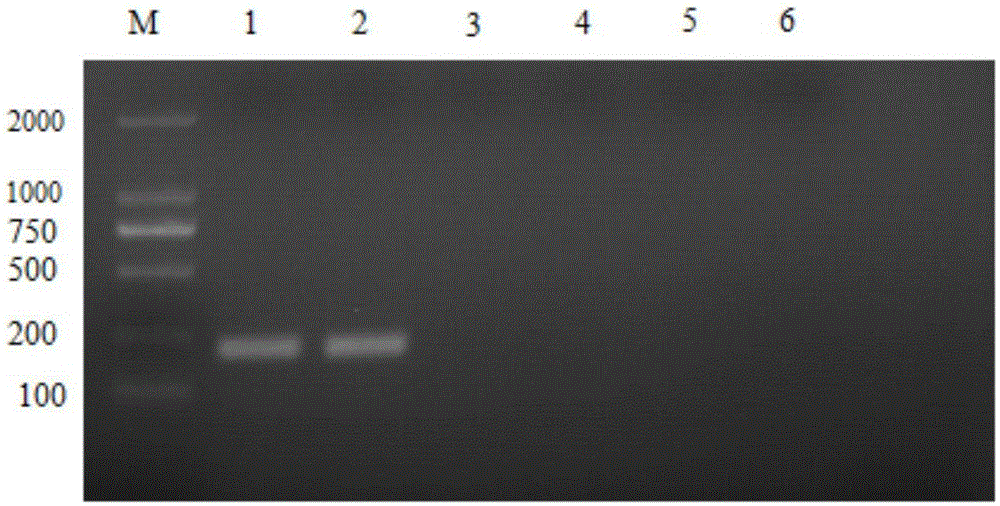 Lactobacillus salivarius for efficiently inhibiting avian pathogenic salmonella and application of lactobacillus salivarius