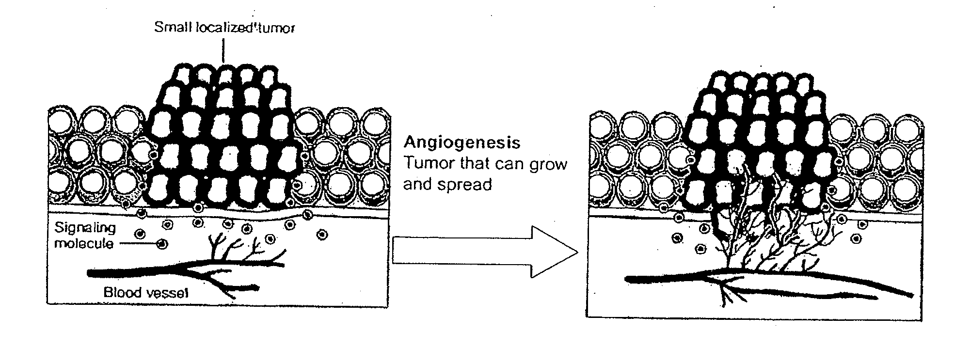 Detection of Activation of Endothelial Cells as Surrogate Marker for Angiogenesis