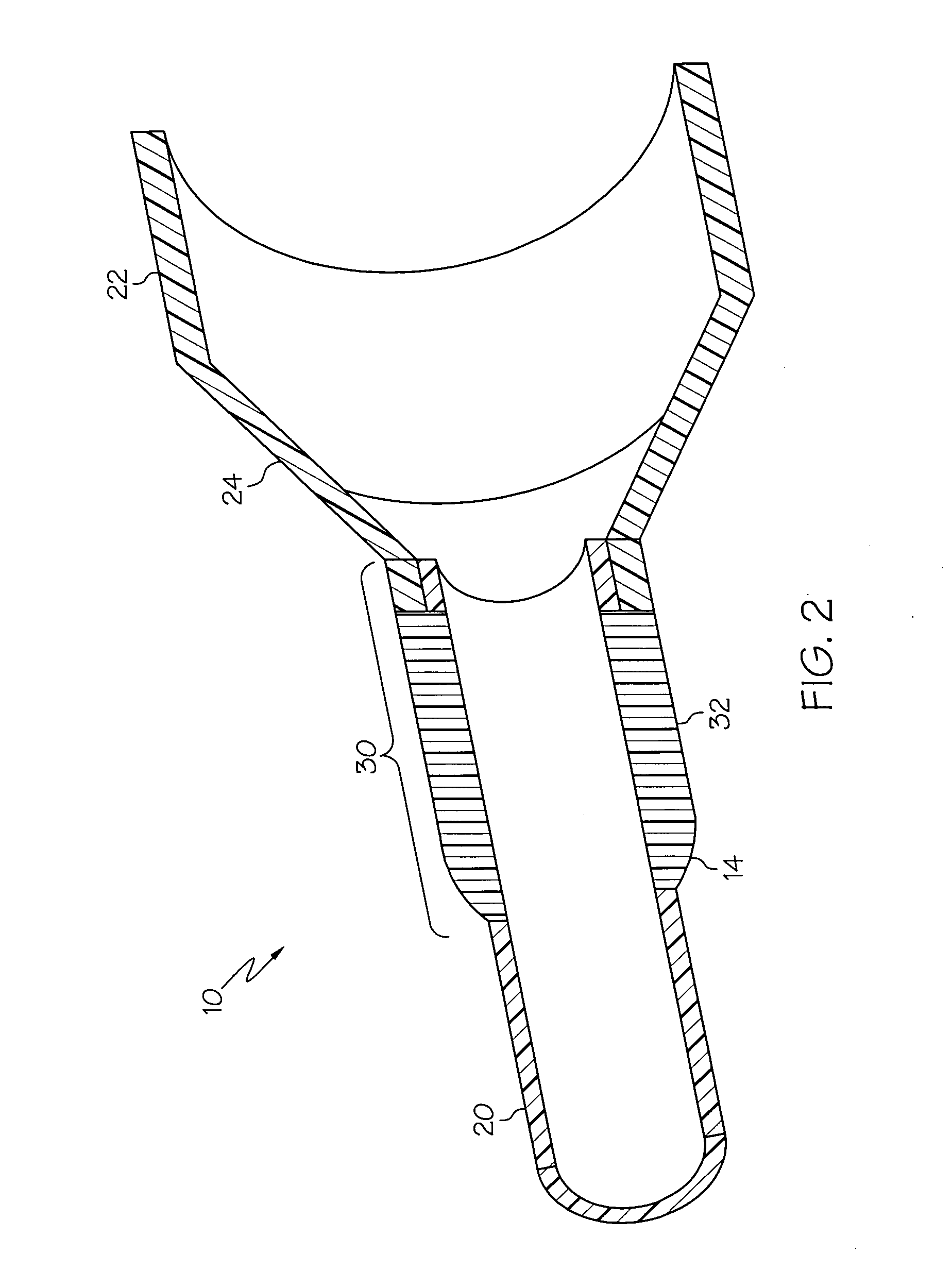 Designs for balloon welds