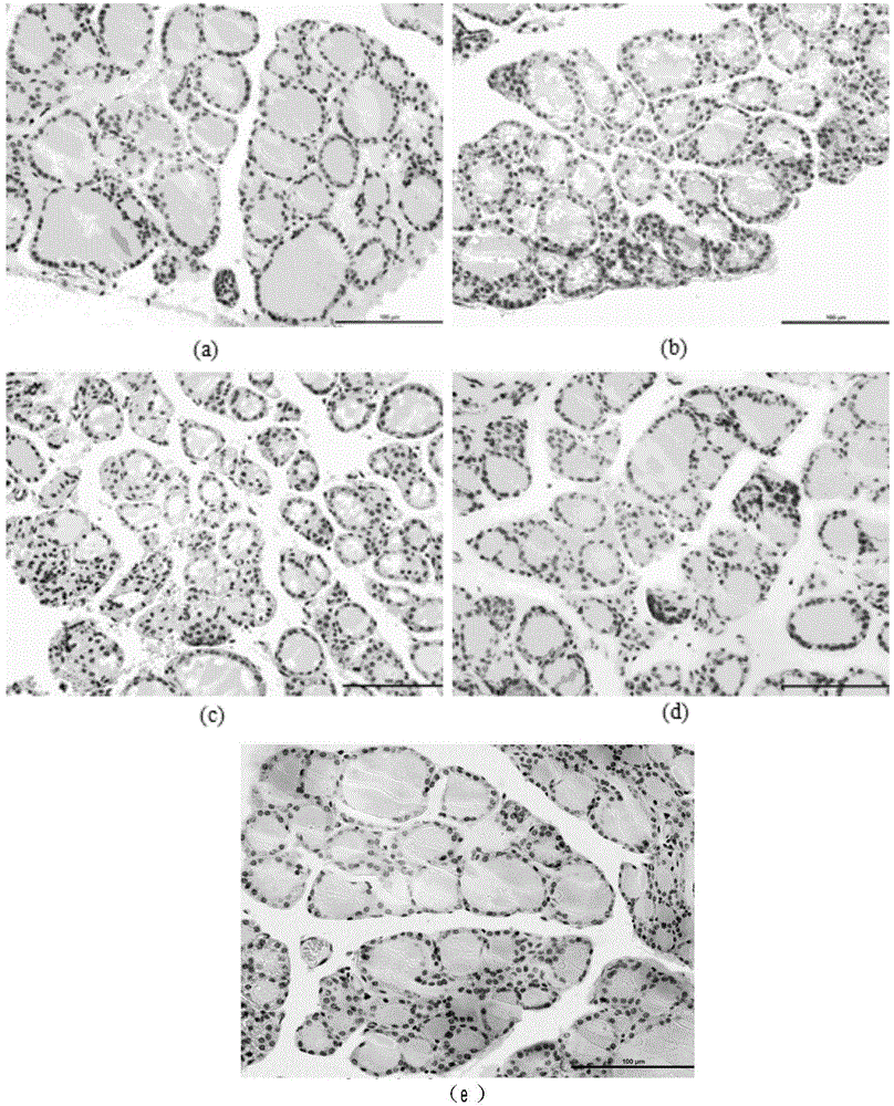 Preparation with hypothyroidism resisting effect, and preparation method thereof