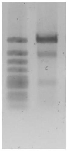 Preparation method of transgenic chicken oviduct bioreactor