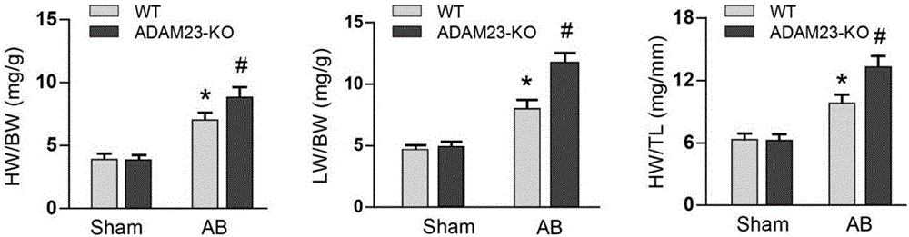 Function and application of disintegrin-metalloproteinase 23 in treatment on cardiac hypertrophy