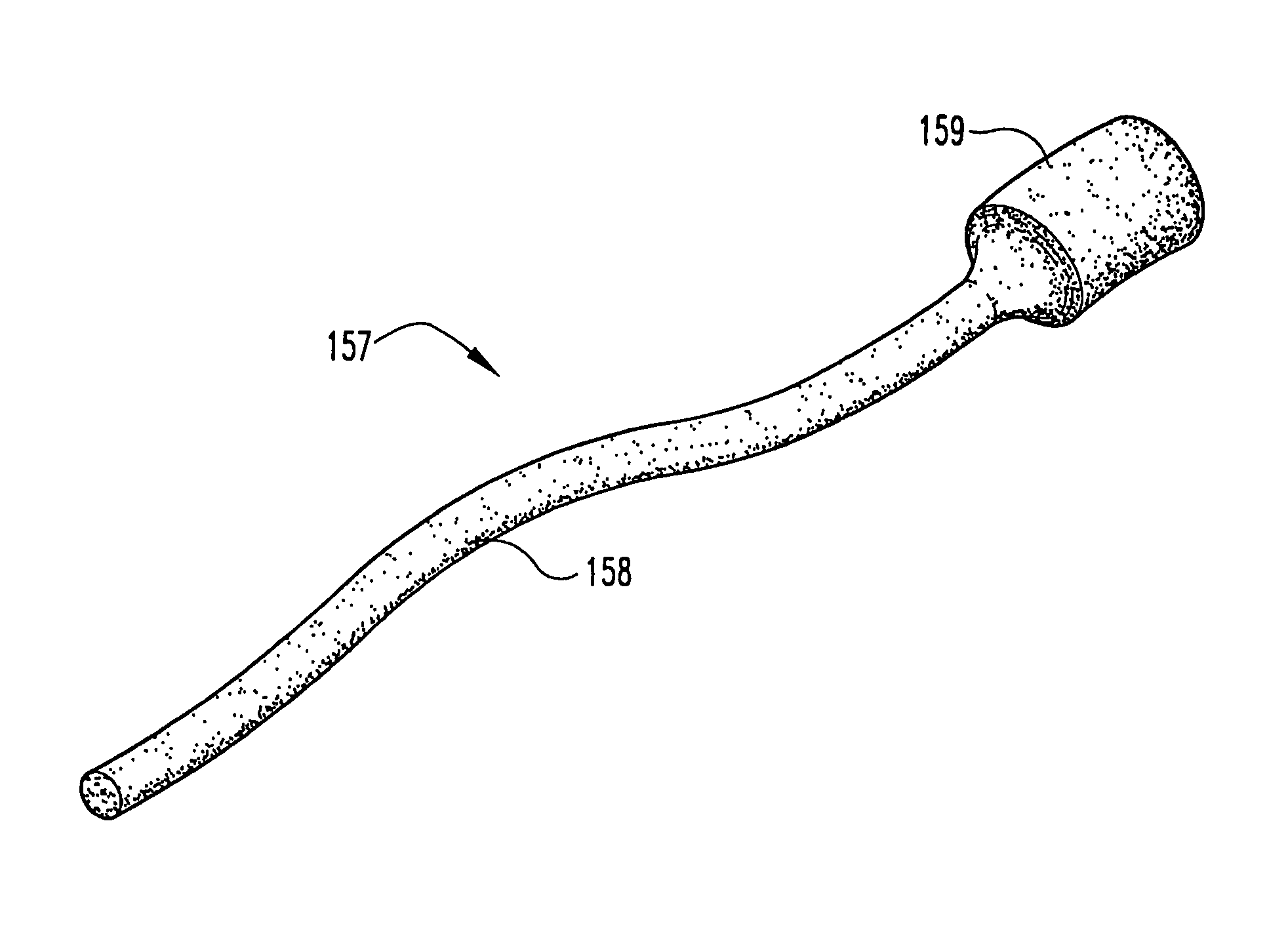 Vascular occlusion methods, systems and devices