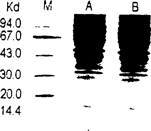 Use of bifidobacterium cell wall and bifidobacterium cell wall protein in pharmacy