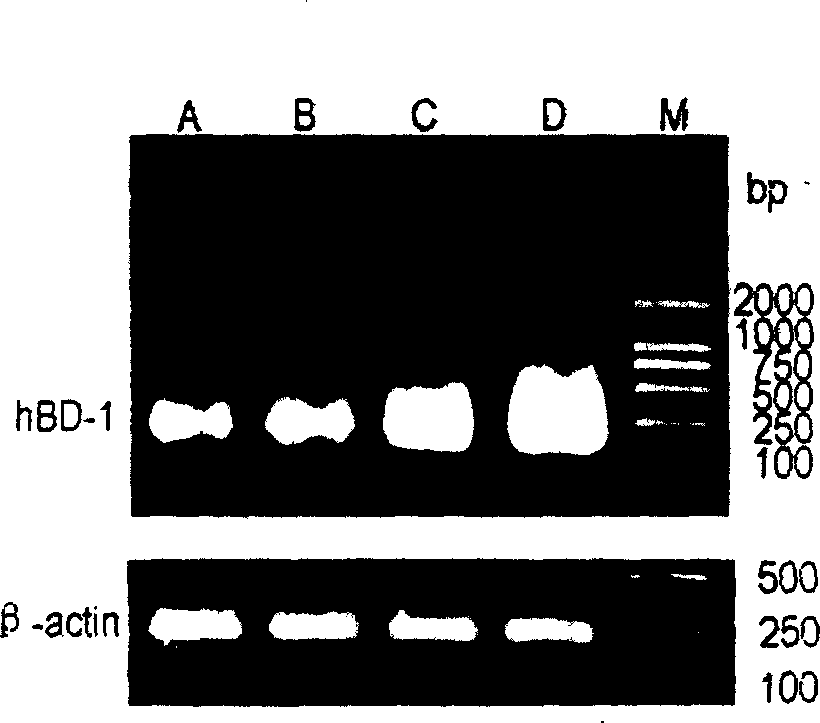 Use of bifidobacterium cell wall and bifidobacterium cell wall protein in pharmacy