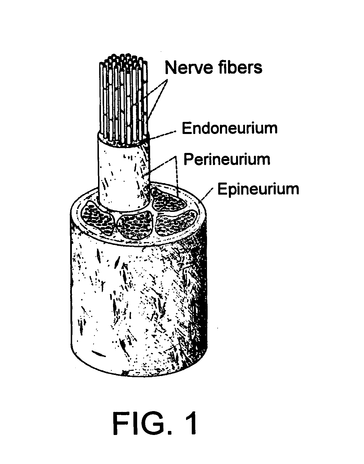 Method and system for providing therapy for bulimia/eating disorders by providing electrical pulses to vagus nerve(s)