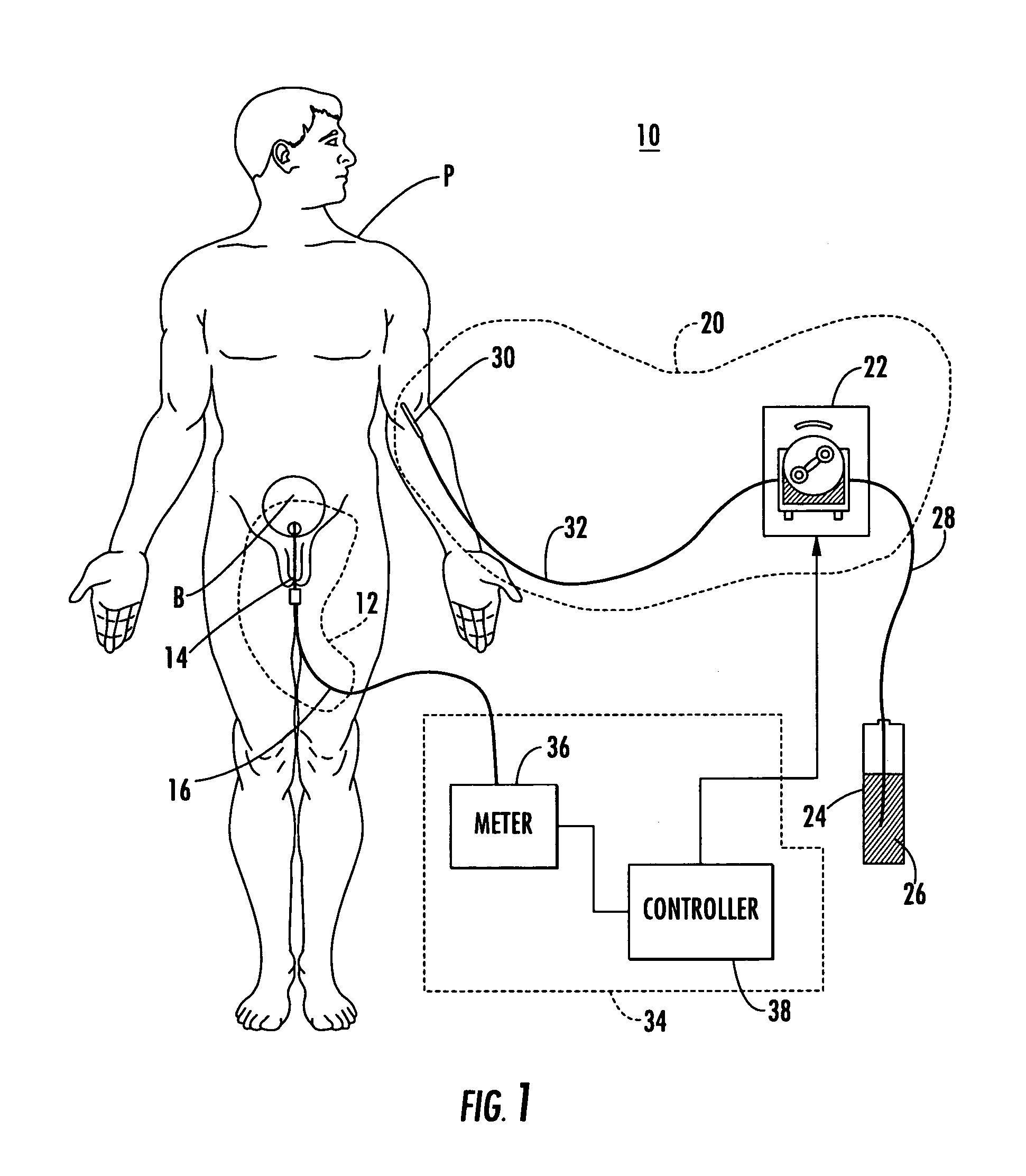 Patient hydration system with a redundant monitoring of hydration fluid infusion