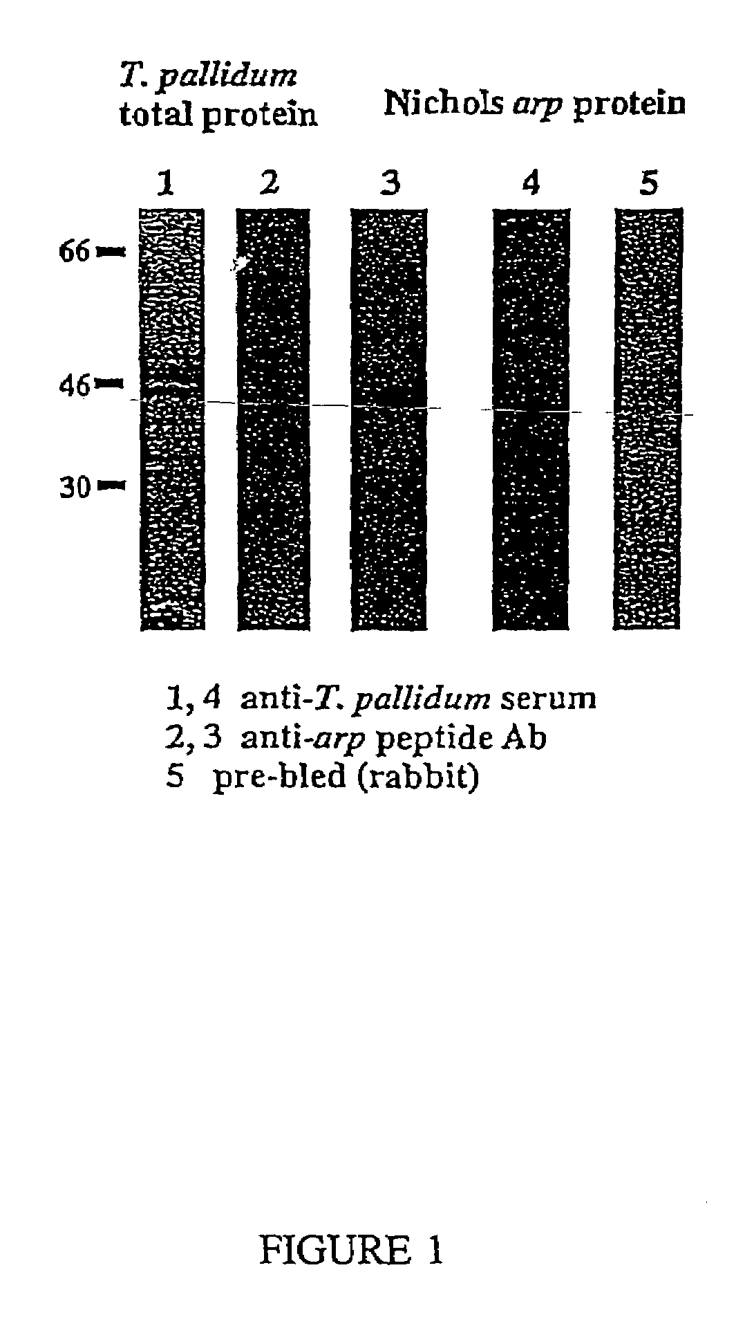 Compositions and methods for detecting <i>Treponema pallidum</i>