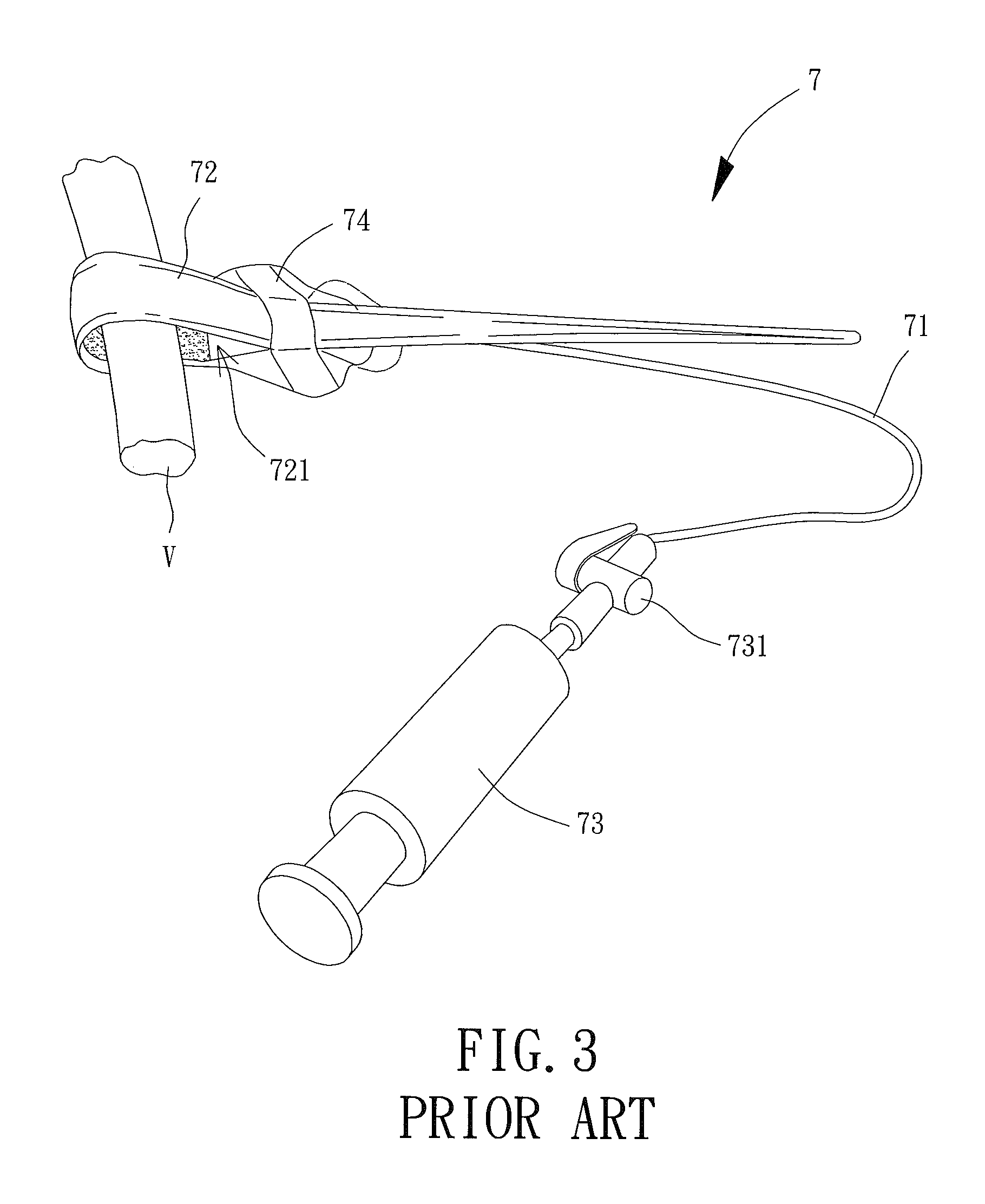 Vascular Clamp for Use in Minimally Invasive Surgery