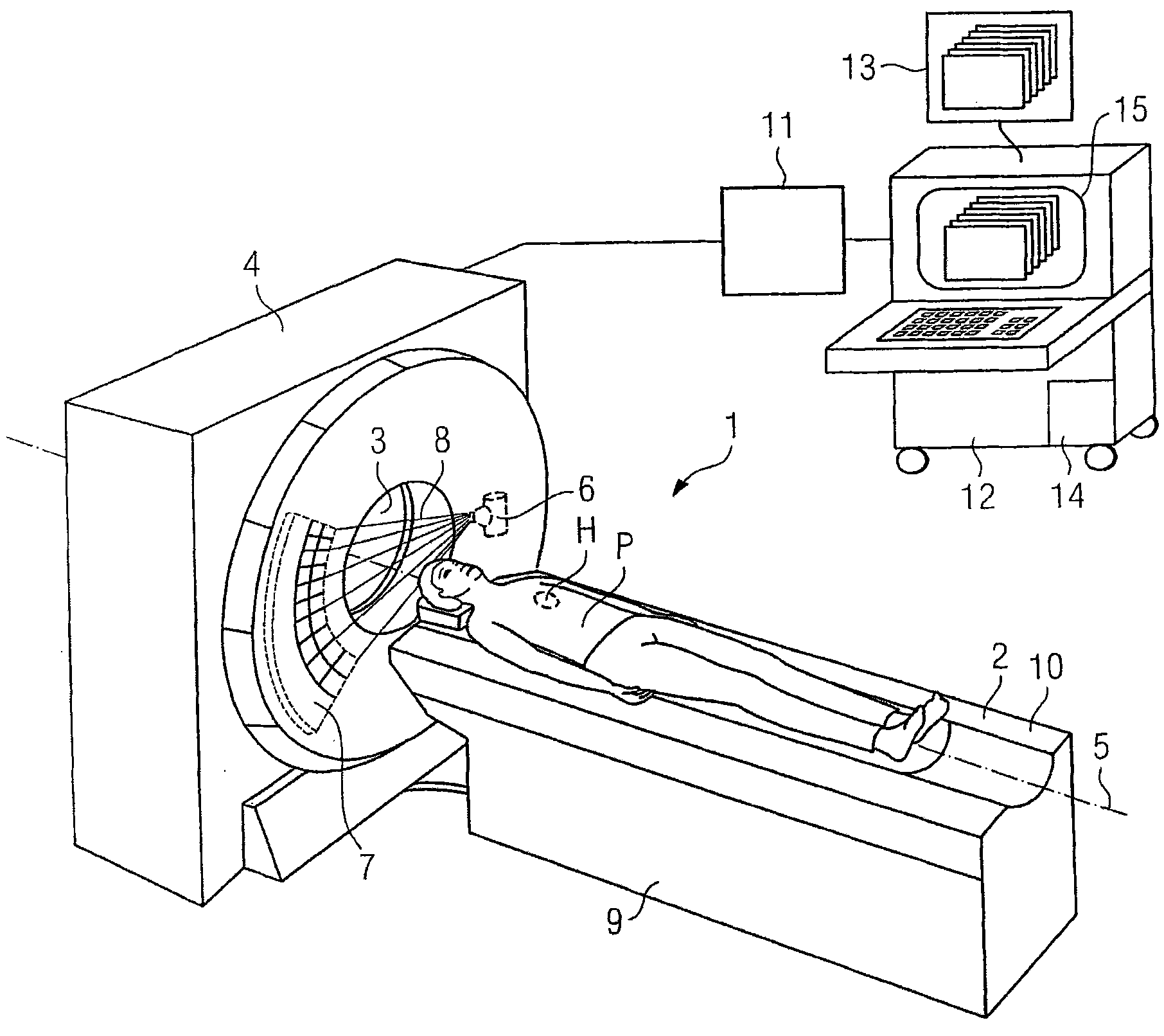 Method and device for identifying and assigning coronary calcification to a coronary vessel and computer program product