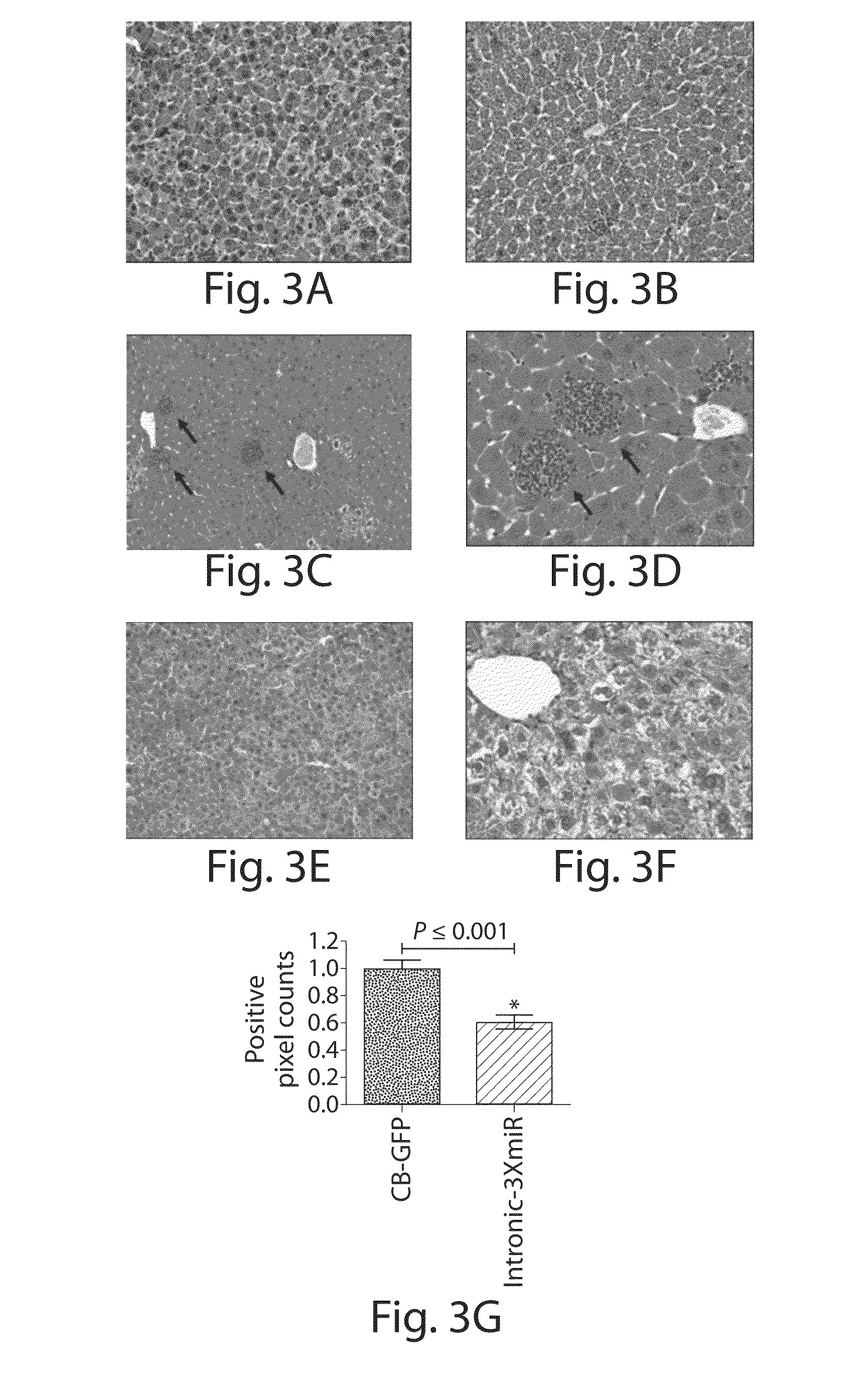 Raav-based compositions and methods for treating alpha-1 Anti-trypsin deficiencies