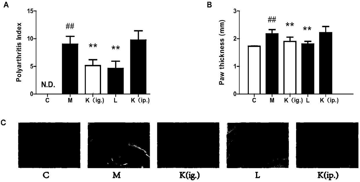 Application of kaempferol in preparation of medicine for rheumatoid arthritis