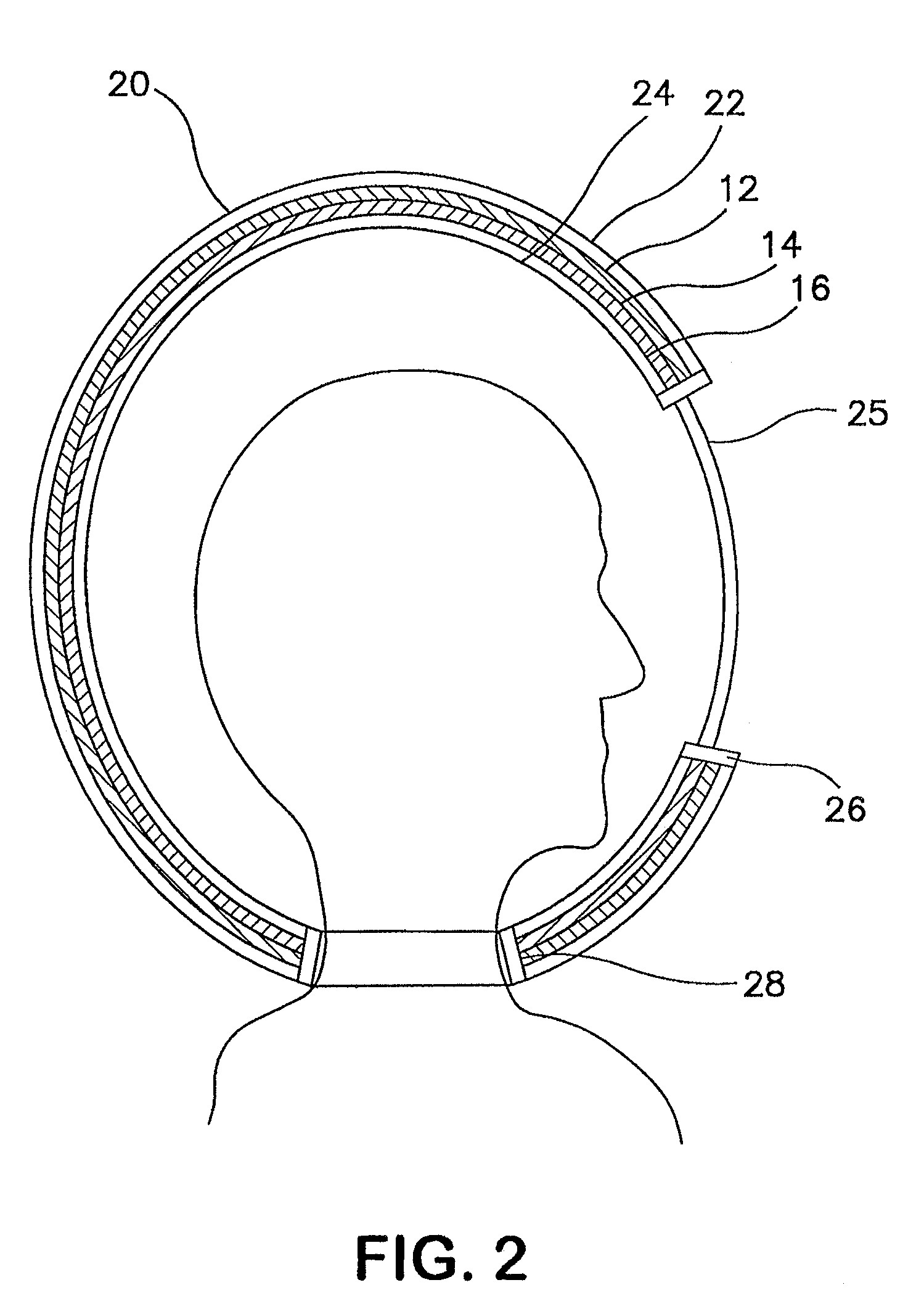 Protective enclosure