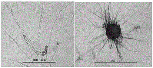 A kind of chaetomium globosa and its application