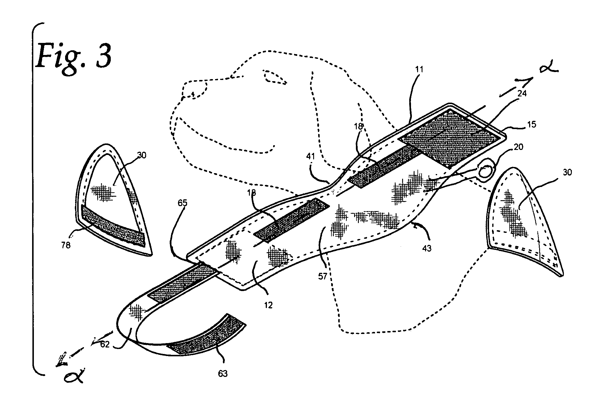 Pet collar with ear guards