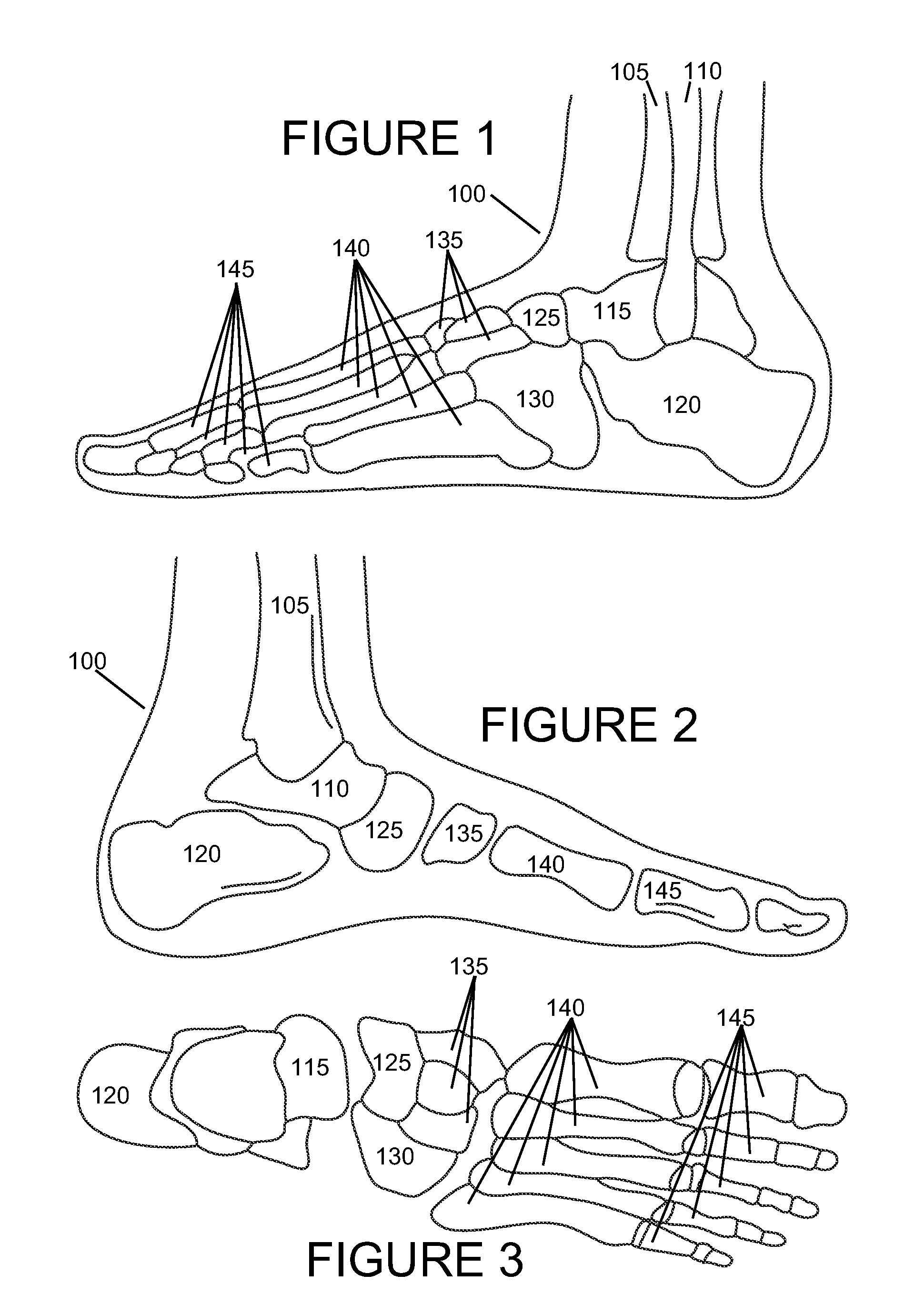 Orthtic device and method for providing static and dynamic stability to the medial arch and subtalar bone complex