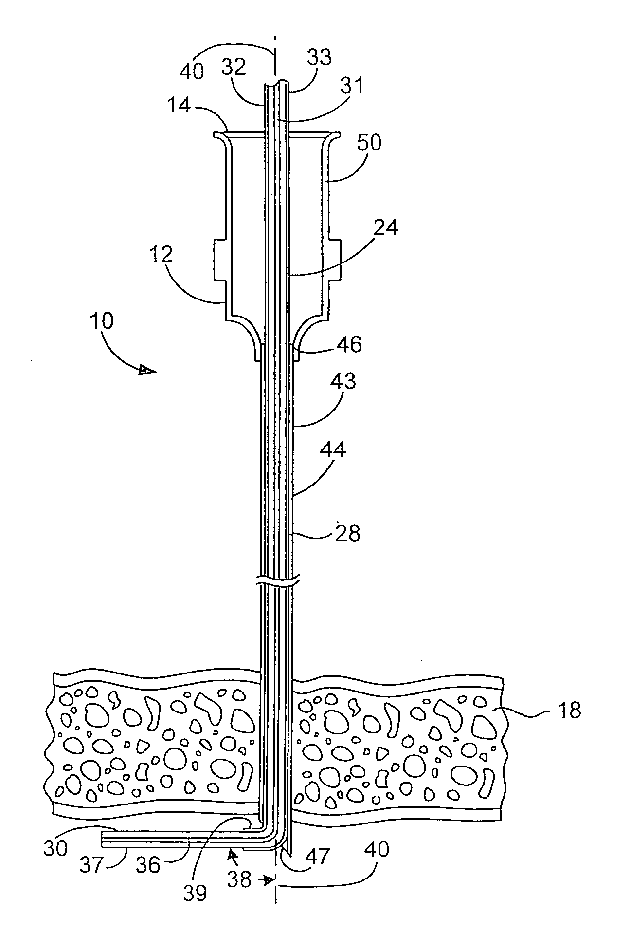 Surgical microwave ablation assembly