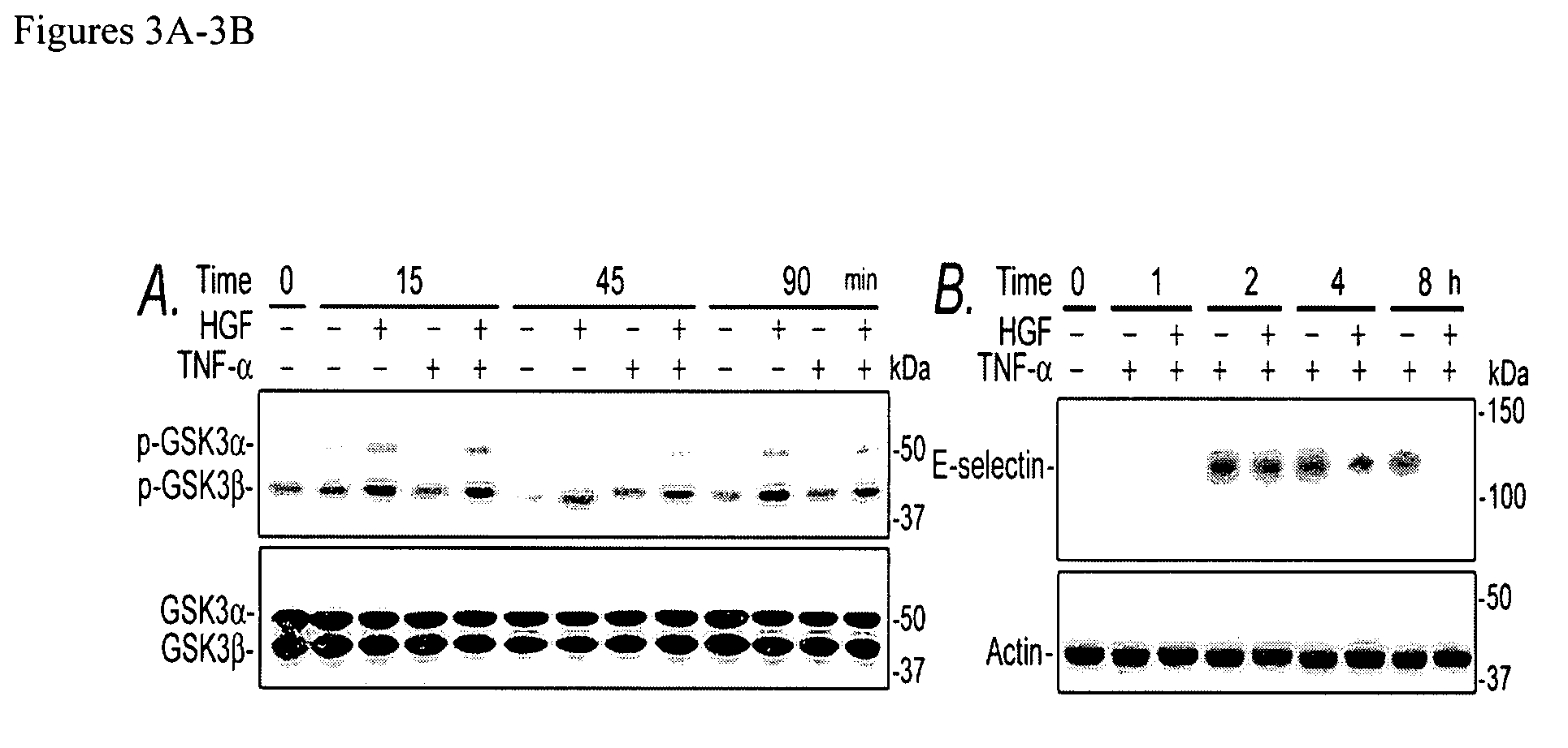 Compositions and methods for detecting and treating renal injury and inflammation